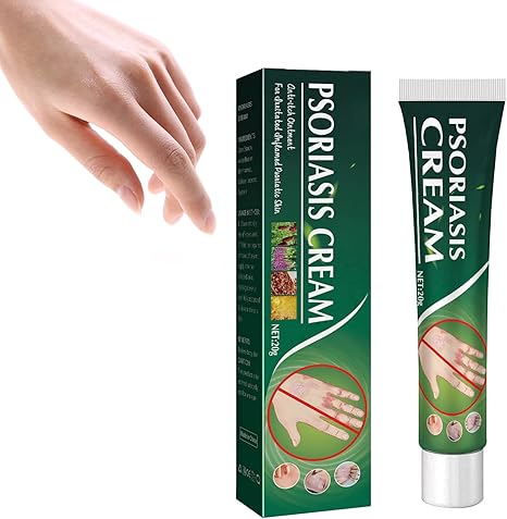 Rešite se Psorijaze Uz South Moon™ – Prirodna Krema za Brzo Olakšanje