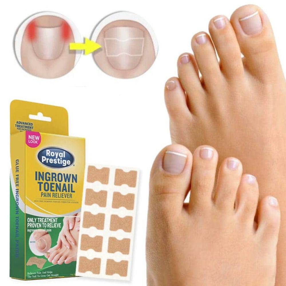 CRNI PETAK -Flasteri za urasle nokte - Idealni za svakodnevnu upotrebu