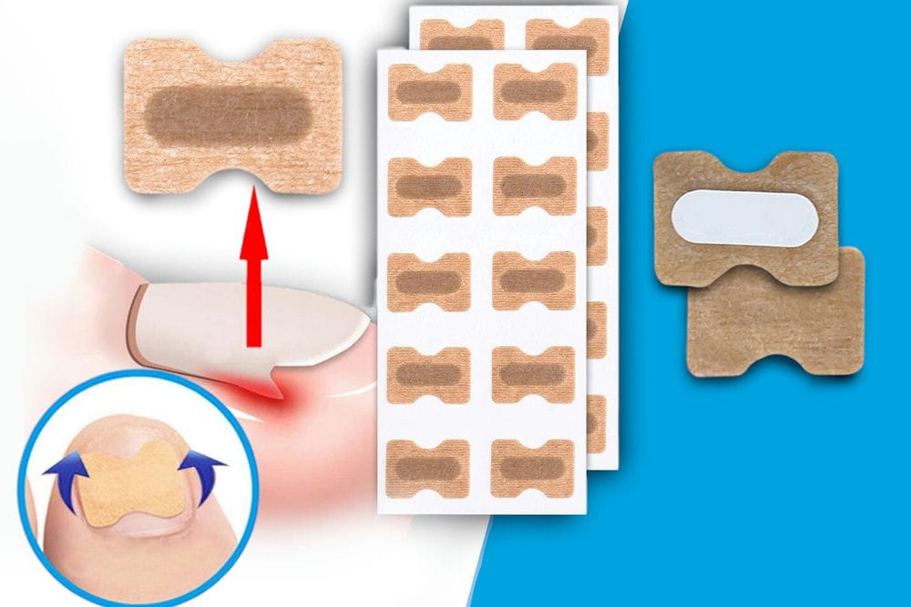 CRNI PETAK -Flasteri za urasle nokte - Idealni za svakodnevnu upotrebu